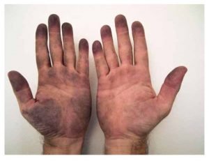 "My hands after holding dirty things", una de esas piezas de ARCO que generan desconcierto a quienes disfrutamos mucho viendo pinturas de Zurbarán y no terminamos de entender bien esto.